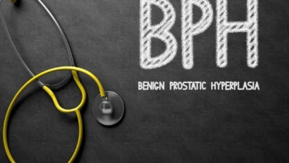 Bringing you the latest news in BPH treatments